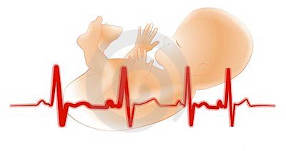 تفسیر NST و نوار قلب جنین
