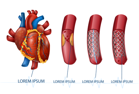 لایه باز سه بعدی آناتومی قلب انسان