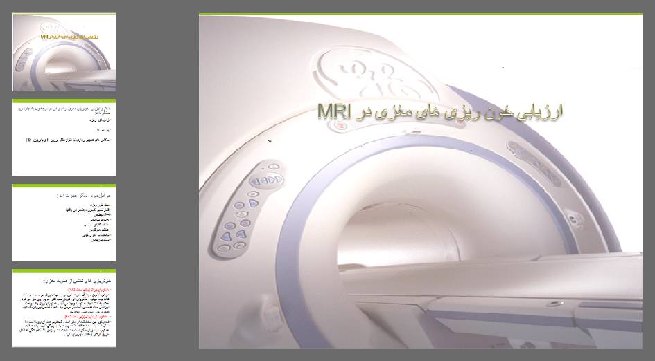 دانلود پاورپوینت ارزیابی خون ریزی های مغزی در MRI