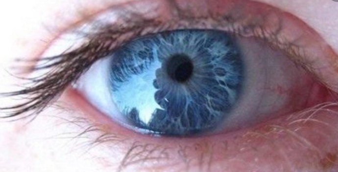 تغییر رنگ چشم به آبی در ۲۹ روز
