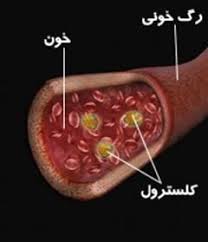 گزارش کار آزمایشگاه با عنوان آزمایش لیبرمن – بوشارد (تشخیص کلسترول)