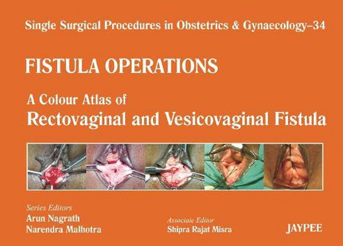 A Colour Atlas of Rectovaginal and Vesicovaginal Fistula