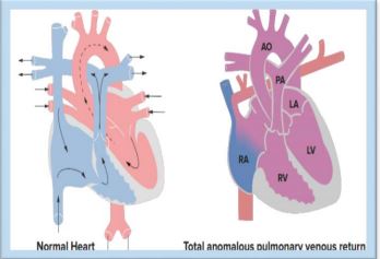 پاتولوژی سیستم قلبی عروقی (فیزیوپاتولوژی)