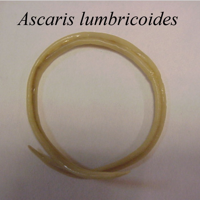 فایل ارائه پاورپوینت کرم آسکاریس: Ascaris lumbricoides