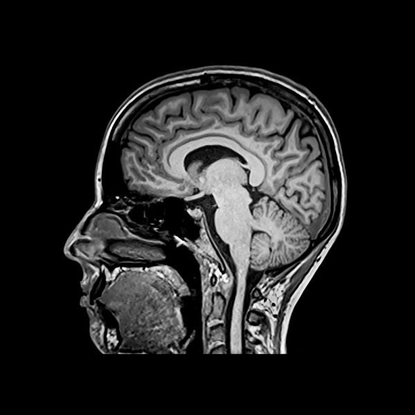 دانلود در مورد توموگرافی از مغز (pdf)