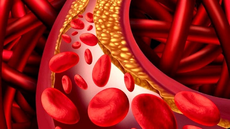 کلسترول خون: راهنمای جامع کنترل و پیشگیری!
