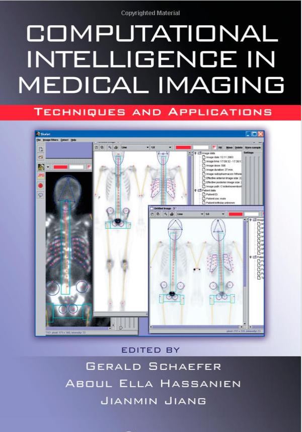 Computational Intelligence in Medical Imaging: Techniques and Applications