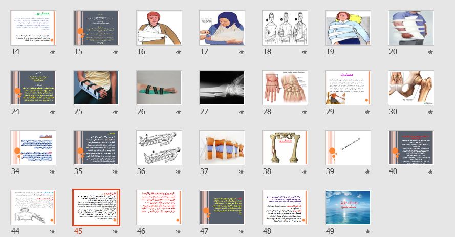 پاورپوینت و pdf درباره "فوریت های شکستگی" در 49 اسلاید