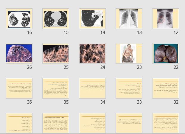 پاورپوینت و pdf "بیماریهای تنفس  COPD – ARF – ARDS" در 58 اسلاید