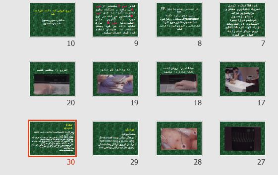 پاورپوینت و pdf درباره "دفيبريلاسيون و كارديوورسيون" در 30 اسلاید