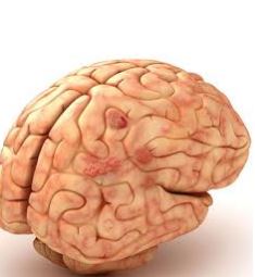 پاورپوینت درباره "عفونتهای مغزی" در 21 اسلاید