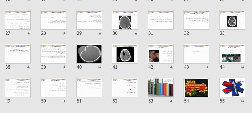 پاورپوینت و pdf "كنفرانس ضربه به سر" در 55 اسلاید