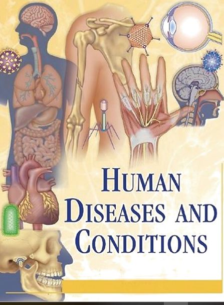 Human Diseases and Conditions