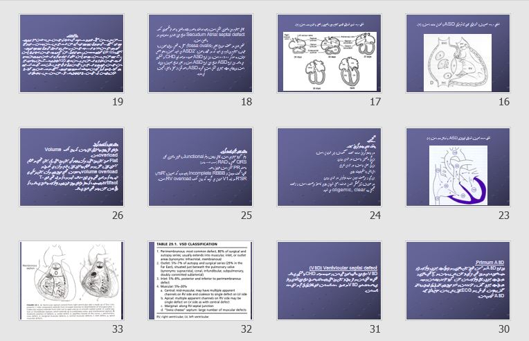 پاورپوینت "بیماری های مادرزادی قلب" 59 اسلاید