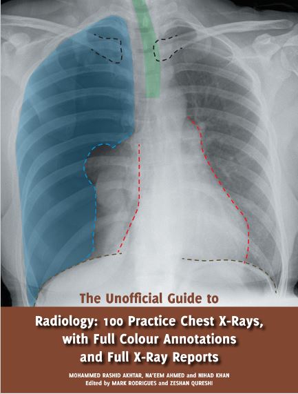 The Unofficial Guide to Radiology: 100 Practice Chest X-Rays, with Full Colour Annotations and Full X-Ray Reports