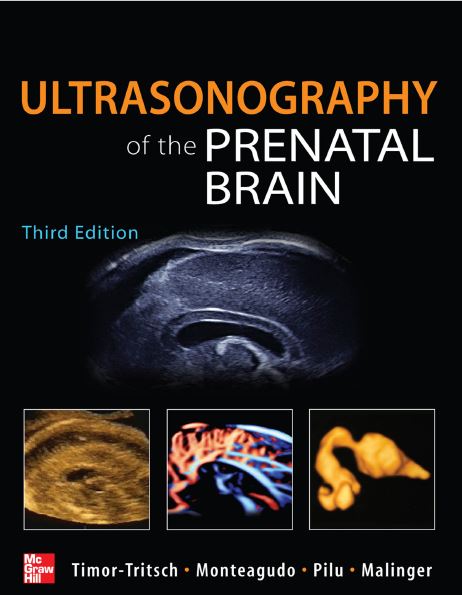 Ultrasonography of the Prenatal Brain